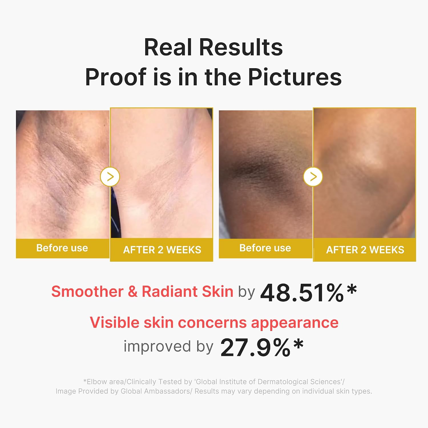 Medicube Body Peel Shot target areas – elbows knees arms legs rough dull uneven body skin brightening Korean bodycare