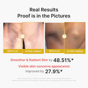 Medicube Body Peel Shot target areas – elbows knees arms legs rough dull uneven body skin brightening Korean bodycare