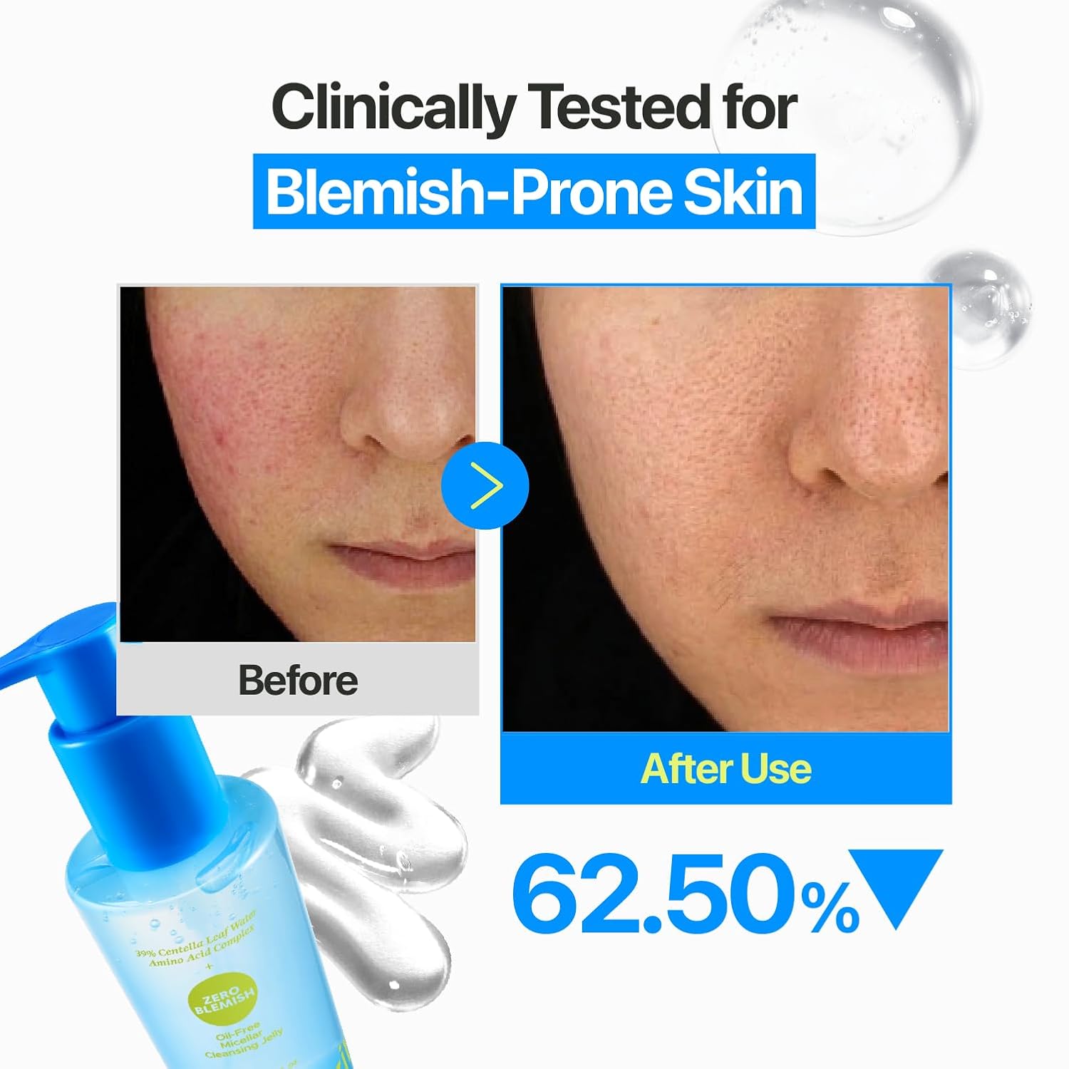 Numbuzin No.0 Zero Blemish Oil-Free Micellar Cleansing Jelly