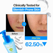 Numbuzin No.0 Zero Blemish Oil-Free Micellar Cleansing Jelly