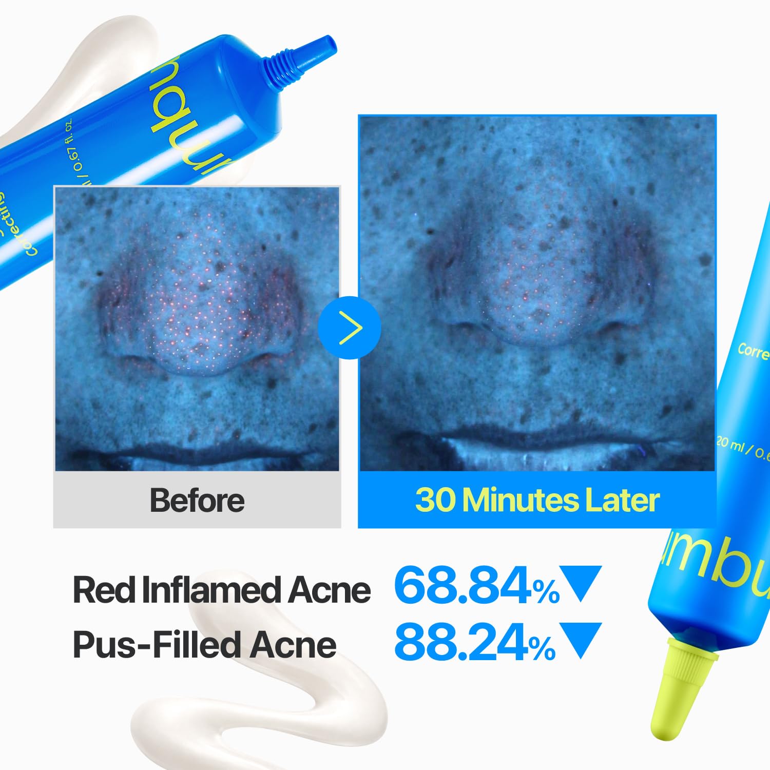 Numbuzin Zero Blemish 3X Spot Correcting Cream