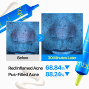 Numbuzin Zero Blemish 3X Spot Correcting Cream
